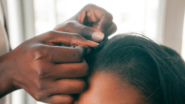 How to Apply Scalp Oil Without Making a Mess